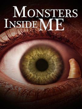 体内的怪物 第二季 Monsters Inside Me Season 2